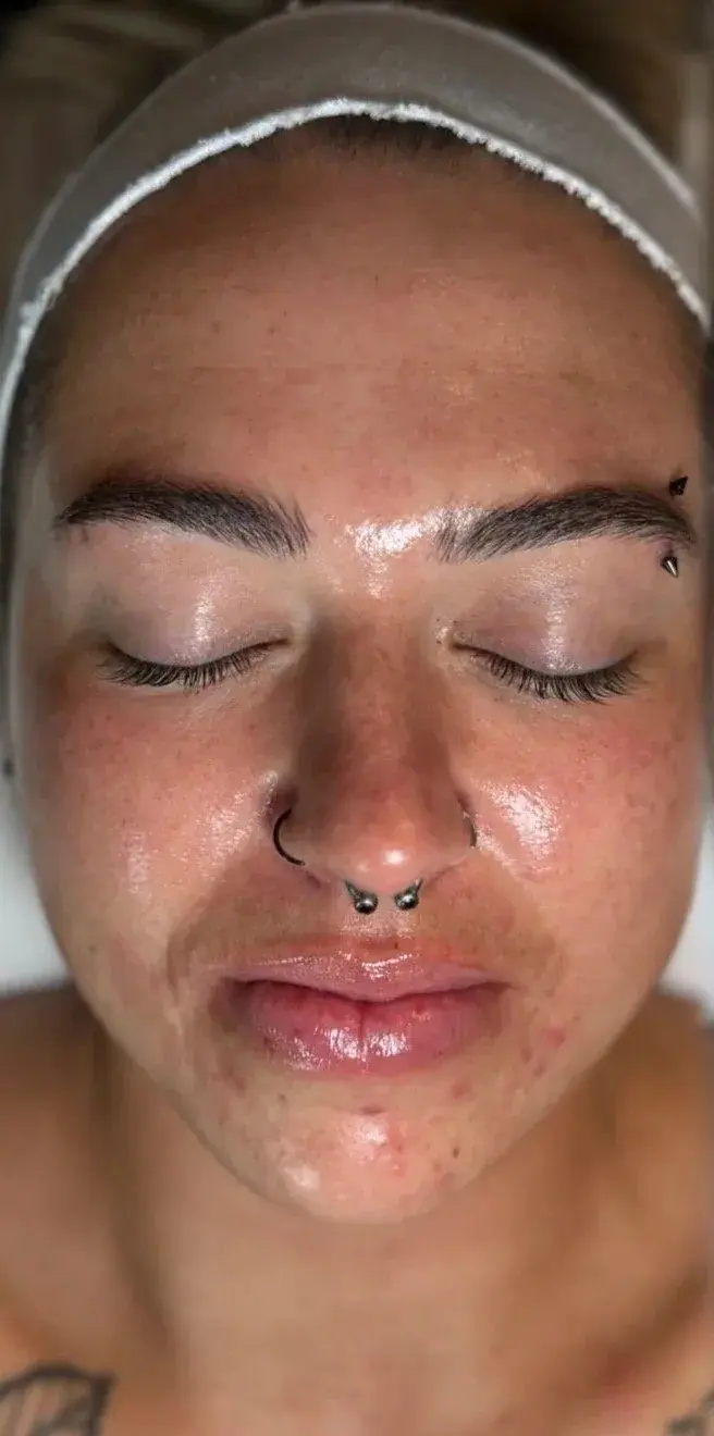Love Your Face Facial, after