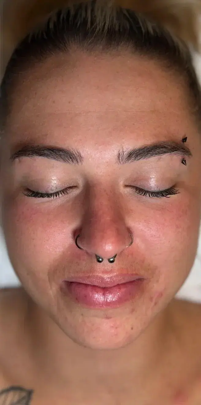 Love Your Face Facial, before