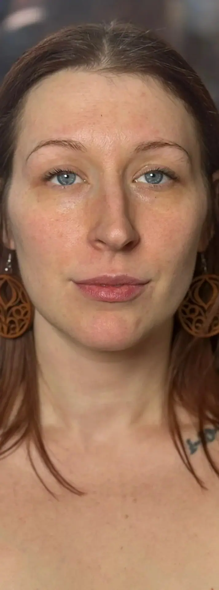 Mini Face Lift, before