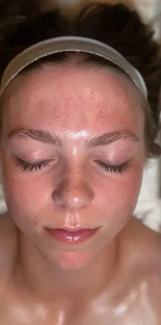 Blush Babe Teen Facial, after