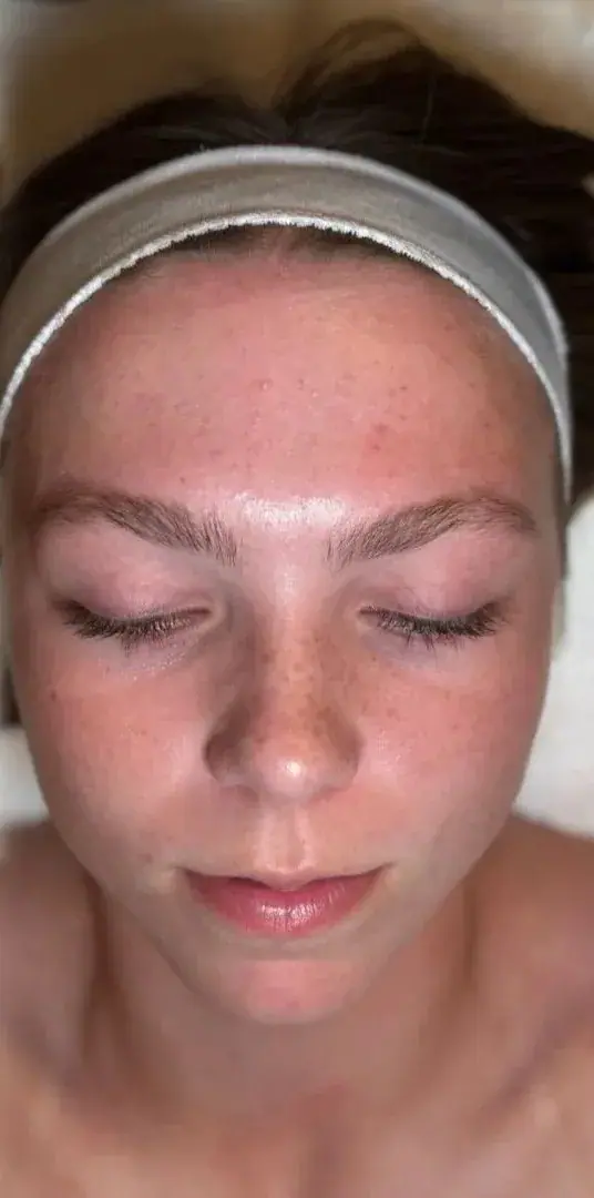 Blush Babe Teen Facial, before