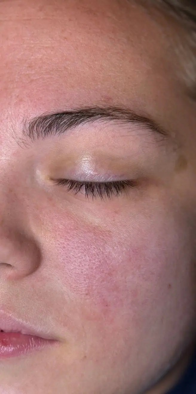 Brow Lamination, before